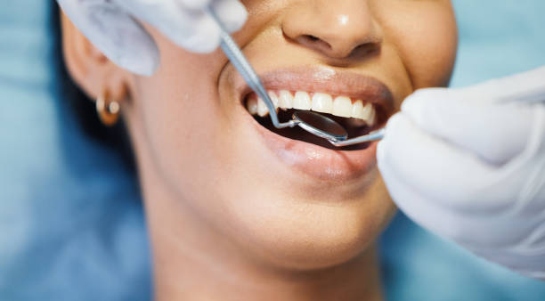 Best Emergency Treatment for Oral Infections in New London, CT